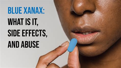 are the double g xanex fake